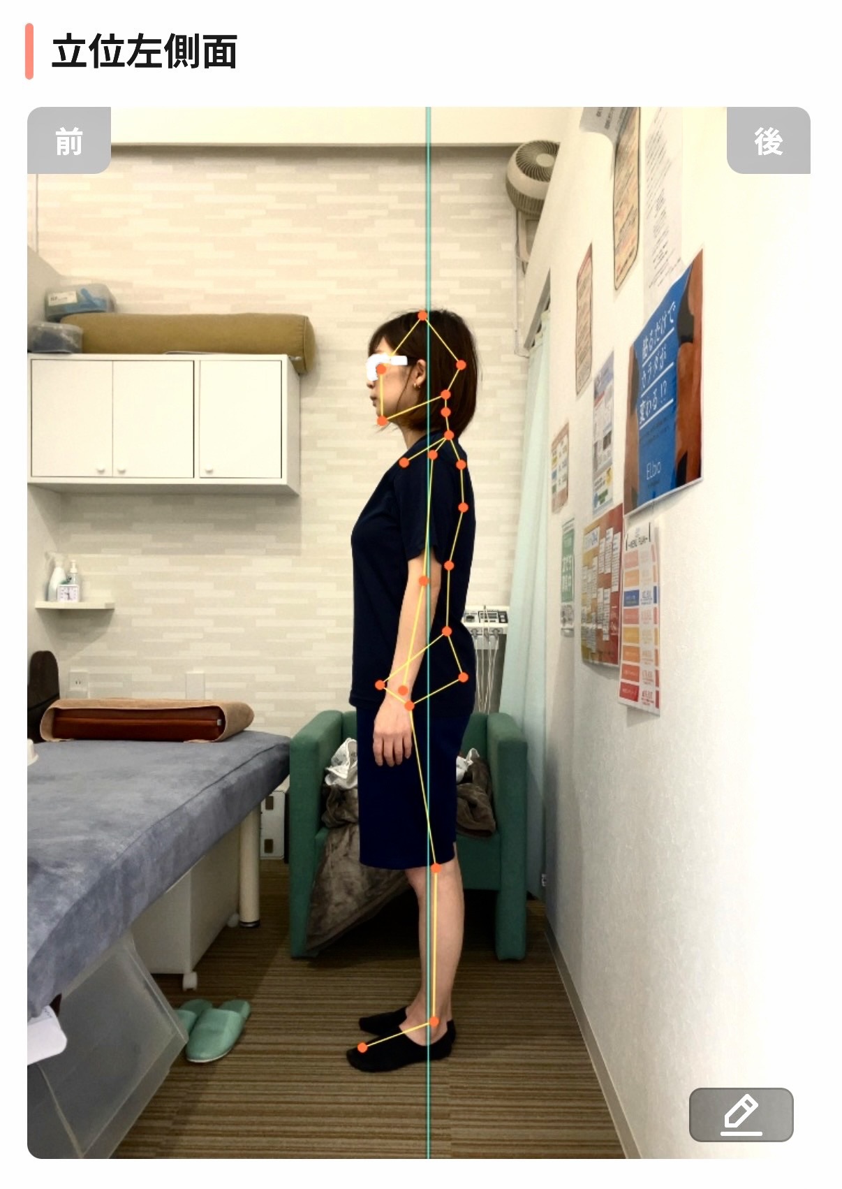 アクル整骨院 | 腰痛 - AI姿勢分析おおのゆかビフォー横
