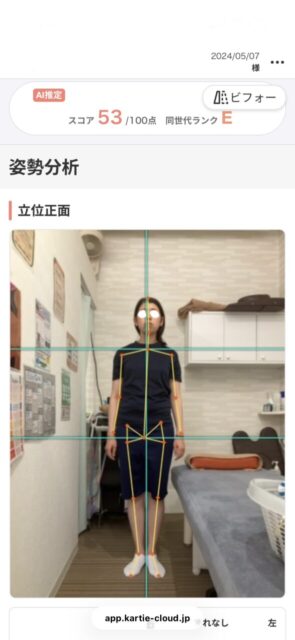 アクル整骨院 | 産後骨盤矯正／町田市金森在住/33歳女性／産後3か月／第1子出産／施術期間 約4か月 - 03c9760eee10879a2c9b20924341af0d-589×1280