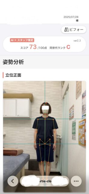 アクル整骨院 | 町田市南町田在住／産後骨盤矯正／産後1か月／第2子出産／33歳女性／施術期間 約3か月／ - 14d72f18caa13aa94d53c72e4318ada0-589×1280