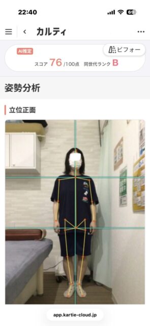 アクル整骨院 | 南町田在住／産後骨盤矯正／27歳女性／産後2か月／第1子出産／施術期間 約3か月／ - 3fc63dab2c03b50900b3a6e10f8563e1-589×1280