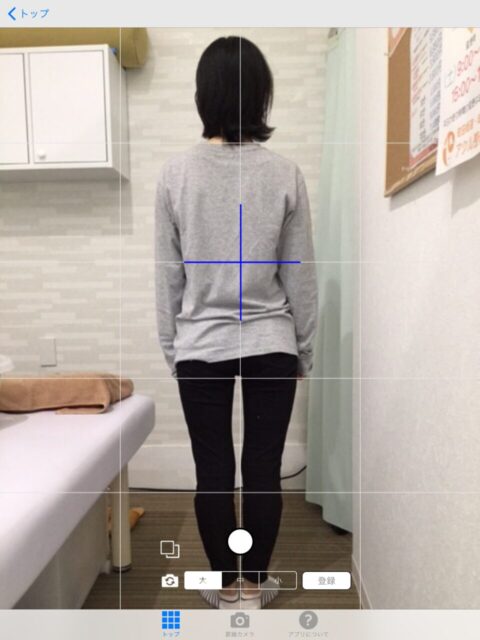 アクル整骨院 | 産後骨盤矯正／31歳女性／産後4か月／第1子出産／施術期間 約4か月／町田市小川在住 - 409d814c89212b905f7410f2a31f5434-960×1280