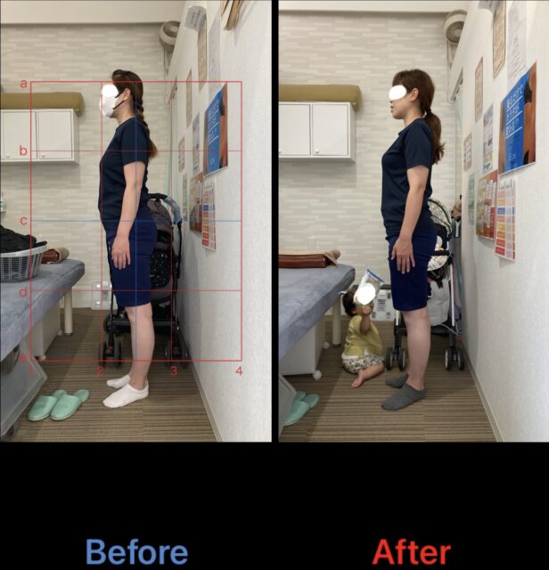 アクル整骨院 | 産後2ヶ月からの骨盤ケア｜ズボンが履けない悩みを早期解決！南町田・成瀬エリア - みむらあおいBA横