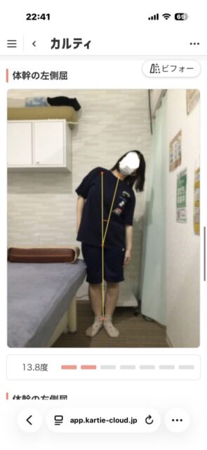 アクル整骨院 | 南町田在住／産後骨盤矯正／27歳女性／産後2か月／第1子出産／施術期間 約3か月／ - 58df14c37534d1554b478ba754b8bb5d-589×1280