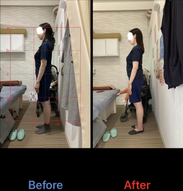 アクル整骨院 | 南町田在住/産後骨盤矯正／31歳女性／産後4か月／第一子出産／施術期間約4か月／ - 62382382418ccdbab66299ca6be8c68b-1232×1280