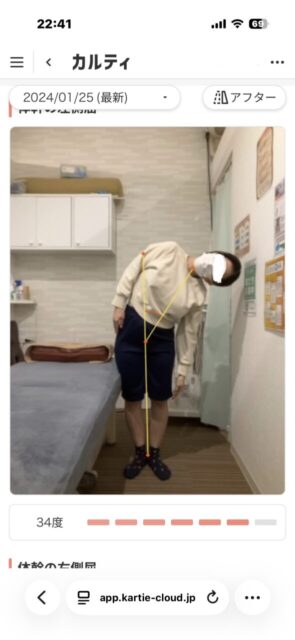 アクル整骨院 | 南町田在住／産後骨盤矯正／27歳女性／産後2か月／第1子出産／施術期間 約3か月／ - 65a154bb23c4ab9ec370597e21f3db35-589×1280