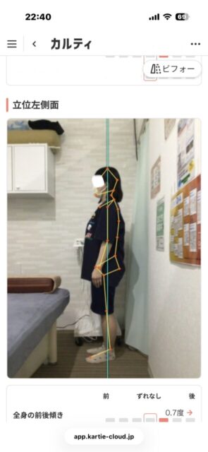 アクル整骨院 | 南町田在住／産後骨盤矯正／27歳女性／産後2か月／第1子出産／施術期間 約3か月／ - 8248c07183b9542b610e38b868e85004-589×1280