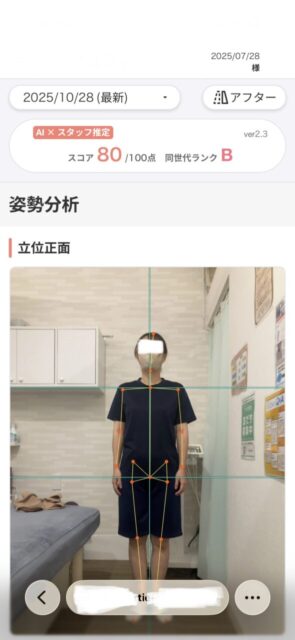 アクル整骨院 | 町田市南町田在住／産後骨盤矯正／産後1か月／第2子出産／33歳女性／施術期間 約3か月／ - b0e889eafee5268d2d584aaab1b40c53-589×1280