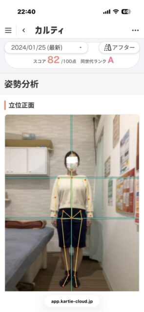 アクル整骨院 | 南町田在住／産後骨盤矯正／27歳女性／産後2か月／第1子出産／施術期間 約3か月／ - dc299fef28bd8b9b4e86452c9a920d97-589×1280