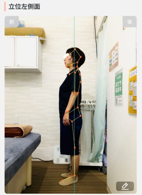 アクル整骨院 | 町田市南つくし野在住／産後2か月／第2子出産／36歳女性／施術期間 約3か月 - 3ca4c21b2b4616493a65a80383f7c743-934×1280