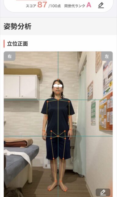 アクル整骨院 | 町田市南つくし野在住／産後2か月／第2子出産／36歳女性／施術期間 約3か月 - 668c5ffd8066d3d6d6e5f91778e55194-768×1284