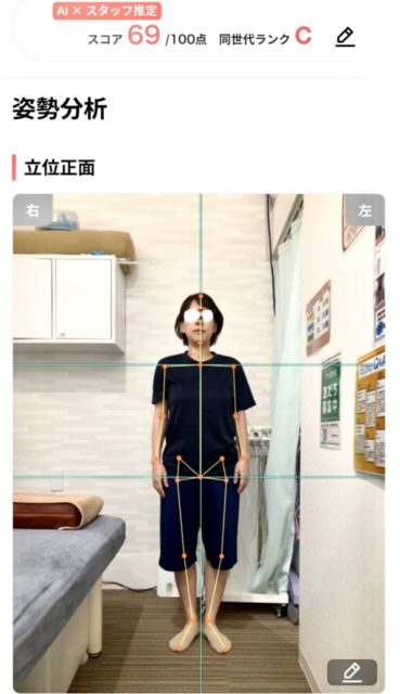 アクル整骨院 | 町田市南つくし野在住／産後2か月／第2子出産／36歳女性／施術期間 約3か月 - 6acee0678dbc92df0a725d27c555ea19-738×1280