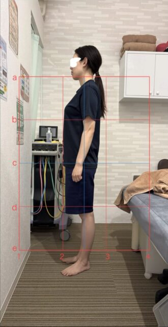 アクル整骨院 | 産後1か月／町田市金森在住/30歳女性／第2子出産／施術期間 約4か月 - 092980f2fd656abb55c85efe5c7d273d-660×1280