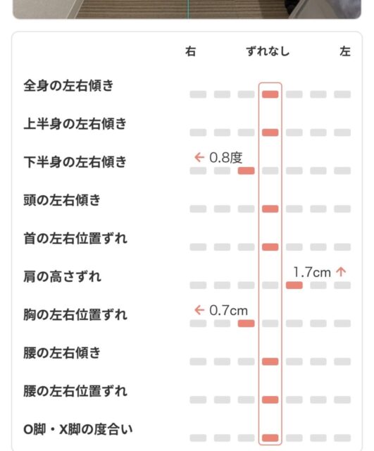 アクル整骨院 | 町田市鶴間在住／産後骨盤矯正／産後6か月／第1子出産／27歳女性／施術期間 約3か月 - Screenshot