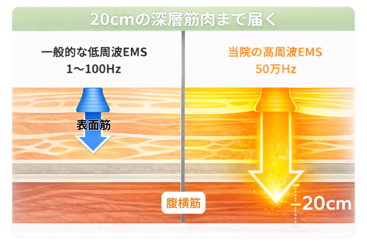 アクル整骨院 | EMS - 小見出しを追加