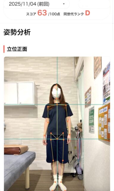 アクル整骨院 | 町田市鶴間在住／産後骨盤矯正／産後6か月／第1子出産／27歳女性／施術期間 約3か月 - ab67b75872c6bd38d98e87af9e222f7e-768×1280