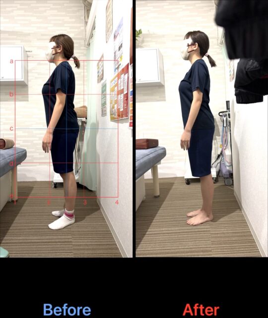 アクル整骨院 | 産後2か月／産後骨盤矯正／町田市金森在住/32歳女性／第1子出産／施術期間 約3か月 - b29e55ada13123e6ff0a7b42747b15b6-1297×1536