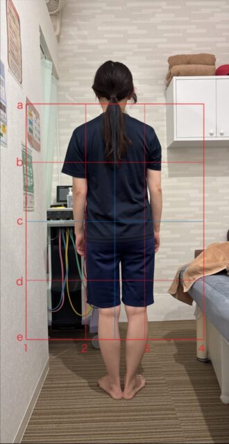 アクル整骨院 | 産後1か月／町田市金森在住/30歳女性／第2子出産／施術期間 約4か月 - b7e2448a5c1cfa6d9691218c7163a44f-660×1280