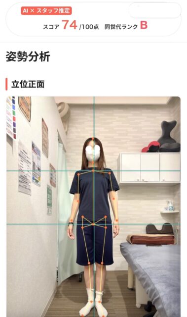 アクル整骨院 | 町田市鶴間在住／産後骨盤矯正／産後6か月／第1子出産／27歳女性／施術期間 約3か月 - b7e33624ddba8c916fbd0ed375dea8a4-757×1280