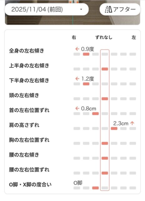 アクル整骨院 | 町田市鶴間在住／産後骨盤矯正／産後6か月／第1子出産／27歳女性／施術期間 約3か月 - Screenshot