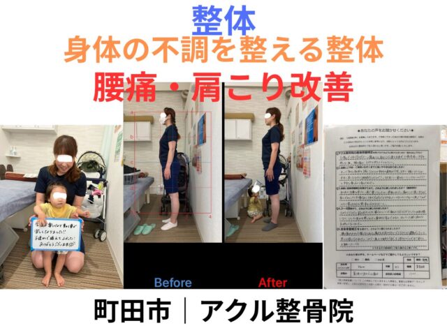 アクル整骨院 | 成瀬・町田エリア　アクル整骨院の整体の特徴とは？2026.3.19㈭ - machida-seitai-youtsu-katakori-akuru-seikotsuin.jpg